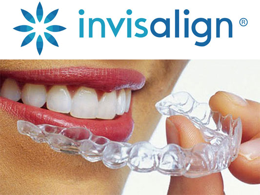 Things to Know About Invisalign